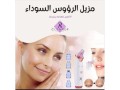 azal-alroos-alsodaaa-otnthyf-albshr-small-0